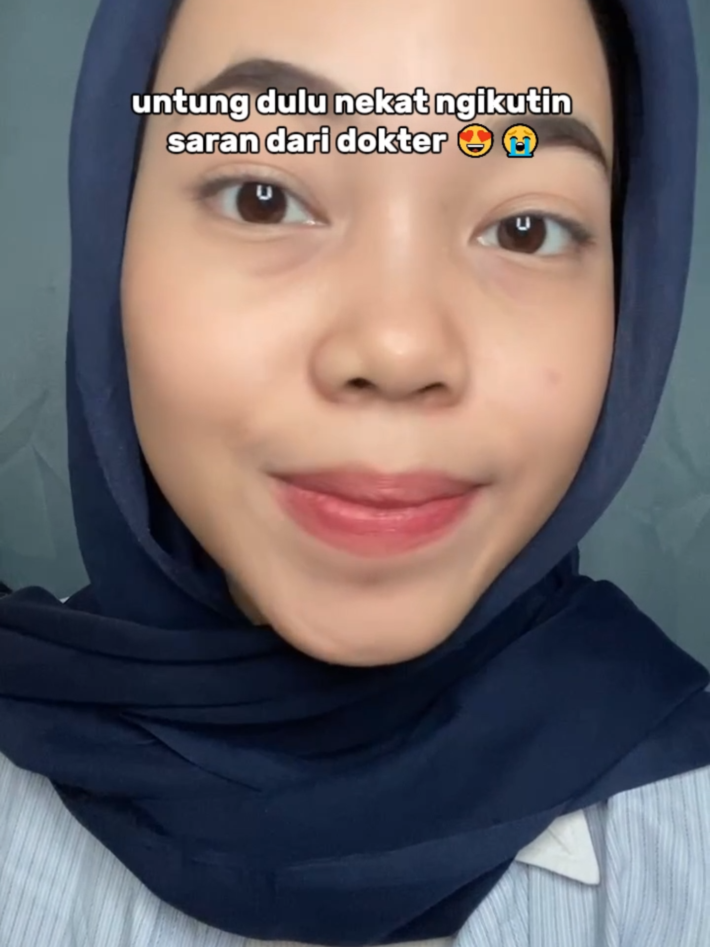Bersyukur banget bisa ketemu produk ini guyss🥺✨#fyppppppppppppppppppppppp #masukberandafyp #ForYourBeauty #skincareroutine #skincareviral #produkhemat #chalonesecreamwhiteningandfreckleremoval #skincaretips #viralvideo1million #chalonese #chaloneseskincare #garishalus #wajahglowing #cerahglowingnatural #viralllllll #mencerahkanwajah