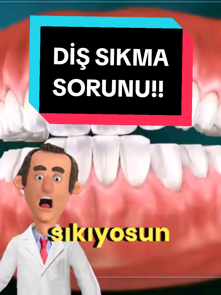 DİŞ SIKMA VE DİŞ GICIRDATMA!! Dişlerini gece sıkıyorsan, sabah sadece çene değil karakterin de kilitlenmiş uyanır. Bruksizm: stresin çeneye indirgenmiş hali. Ağzı Bozuk Dişçi olarak net konuşuyorum: Problem belirlenir Plakla çene barışır Ama önce sen kendinle barışacaksın #bruksizm #dişsıkma #çenesıkma #dishekimi #dişgıcırdatma 