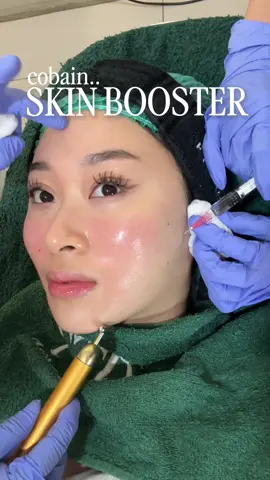 SKINBOOSTER 15 JUTA, worth it ga?? #NoGatekeep : cobain @Profhilo South East Asia 