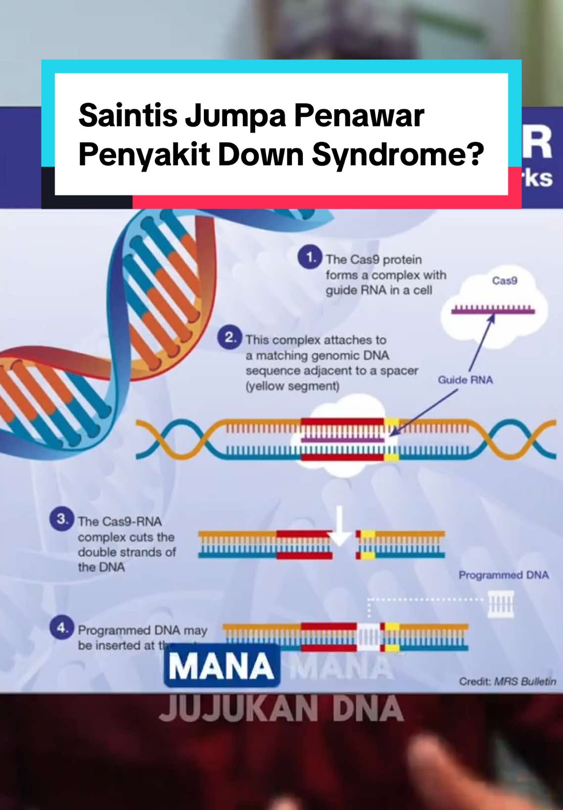 Sindrom Down ni sejenis penyakit genetik. Jadi kalau nak rawat dia, kita memang kena guna kaedah rawatan genetik macam ni. #sindromededown #penyakitgenetik #penyakit #genetik #sains