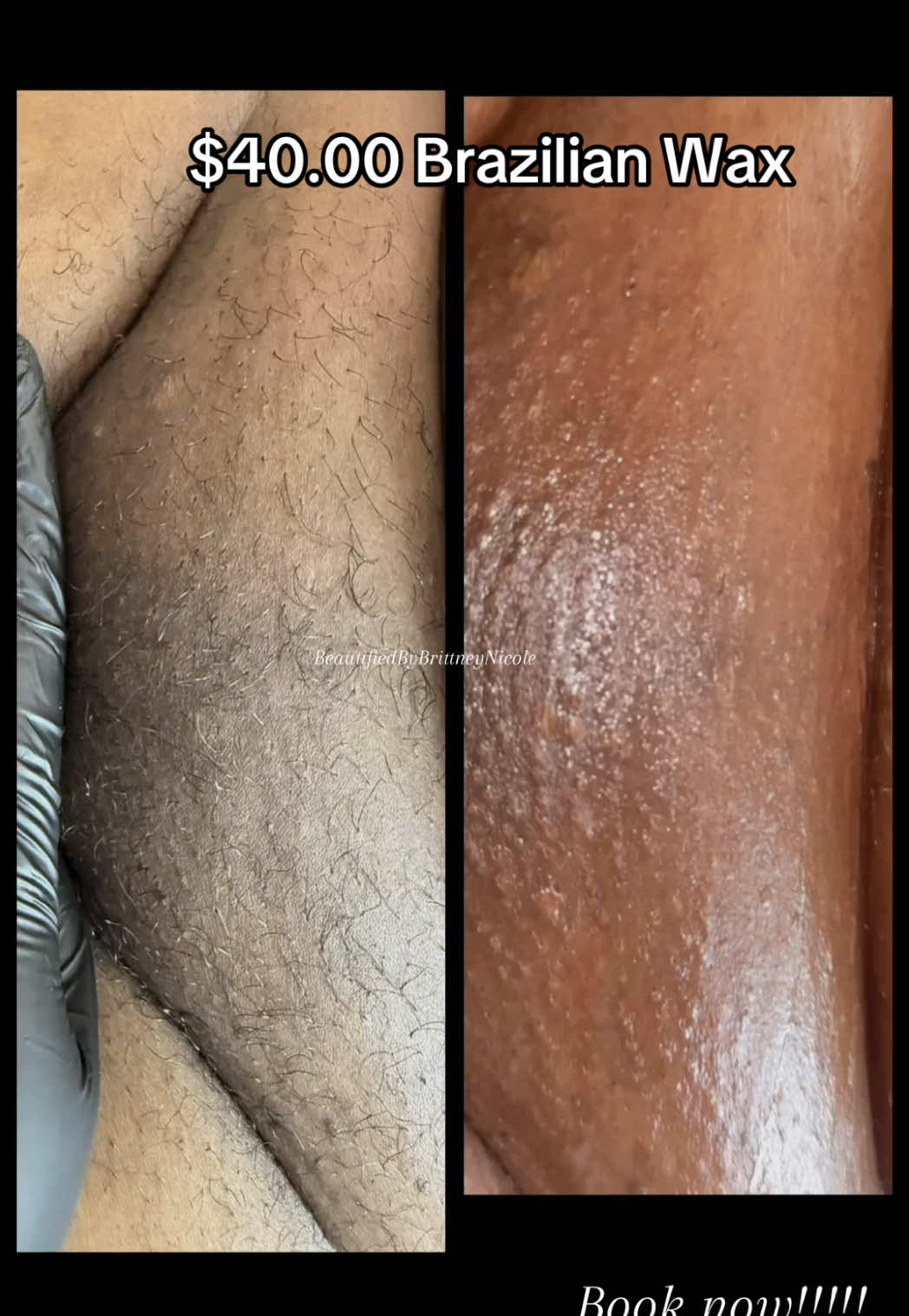 $40.00 Brazilian Waxes on Wednesday 🥰 Please tell me you’re not still shaving!!!??! 😭  Throw those 🪒 away and get waxed TODAY!!! 😆♥️ Book with the BEST now! We don’t miss any hair! 💋💋💋😁😁🐱 Brazilian waxing also reduces skin hyperpigmentation that results from aging, while increasing your blood circulation, which helps drain built-up toxins from your skin and break up fatty tissues, resulting in healthy, glowing, beautiful skin.  Link in my bio! On Wednesdays we Wax!!! Each and every Wednesday a full Brazilian Wax is only $40.00!!! Get waxed by the Best!!!  Come see Your Favorite Licensed Esthetician 💕❣️ .⁣ .⁣ .⁣ .⁣ .⁣ #blackesthetician #brazilianwax #brazilianwaxdetroit #waxedwednesday #brazilianwaxing #brazilianwaxologist #brazilianwaxspecialist  #beautifiedbybrittneynicole #landingstrip #esthetician #estheticianlife  #eyebrowwaxing #facial #facials #glowingskin #lashes #bikiniwax #lashextensions #licensedesthetician #skin #skincare #skincareroutine #smoothskin #softwax  #underarmwax #wax #waxing #waxingspecialist #waxspecialist #beforeandafter #booknow 