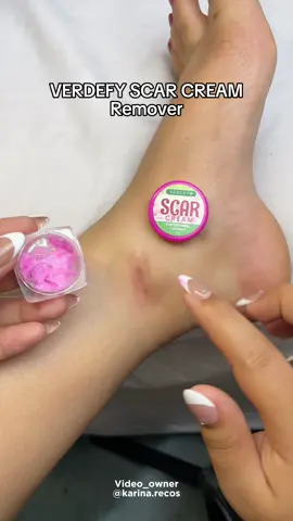 Grabe ang galing nitong pantanggal ng peklat! Try mona! #scarremover #verdefyscarremovercream  #verdefy #scarremovercream #peklatcream 