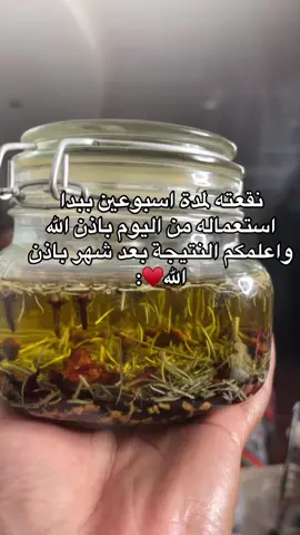 حالفه احرب كل شي على شعري🗿|| #fyp #اكسبلور #عنايتي #عناية_بالشعر #foryou 
