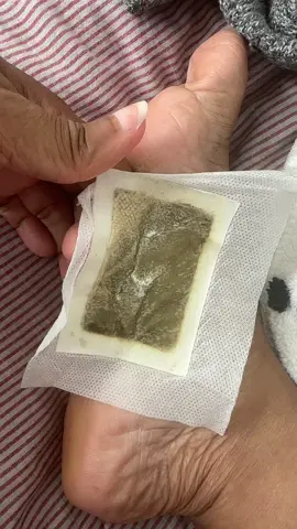 Foot pad detox OXY works by drawing out toxins through your skin while you sleep, helping improve circulation and supporting natural detox.” #DetoxPads #FootDetox #NaturalHealing #CleanseAndReset #WellnessJourney 