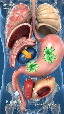 Remedio casero para eliminar el aire y pedos apestosos del cuerpo #remediocasero #eliminaaire #pedosapestosos #manzanilla #bicarbonato #limon 