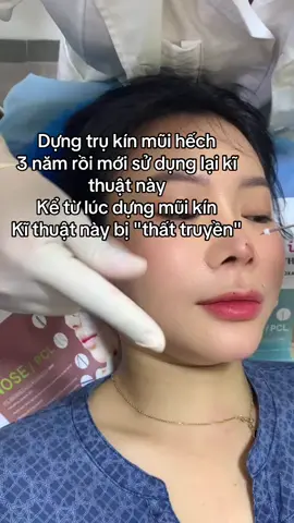 ❤️Thiết Kế Sợi Chỉ Collagen ❤️                 Phục hồi vẻ đẹp của Bạn Lịch làm việc  18-19-20-21 /8 HCM 22-23-24/8 Cần Thơ  26-27-28- 29-30-31/ 8 HCM 12-13-14/ 9 Hà Nội 24-25-26-27-28-29/9 : Seoul  _Căng chỉ _ Filler_Botox_Meso_BAP _Tặng video  kĩ thuật khi  mua chỉ _Tặng hình ảnh quảng cáo về dịch vụ _Đào tạo Căng chỉ từ cơ bản đến nâng cao _Kết hợp đào tạo và làm dịch vụ với TMV toàn quốc và quốc tế. #Đào_tạo_căng_chỉ_Nâng_cơ_mặt#căngChỉCollagen_Thắt_nọng_cằm_ #nâng_cơ_táo_NângTầngMặtGiữa #Filler#Đào_tạo_căng_chỉ_Nâng_cơ_mặt 