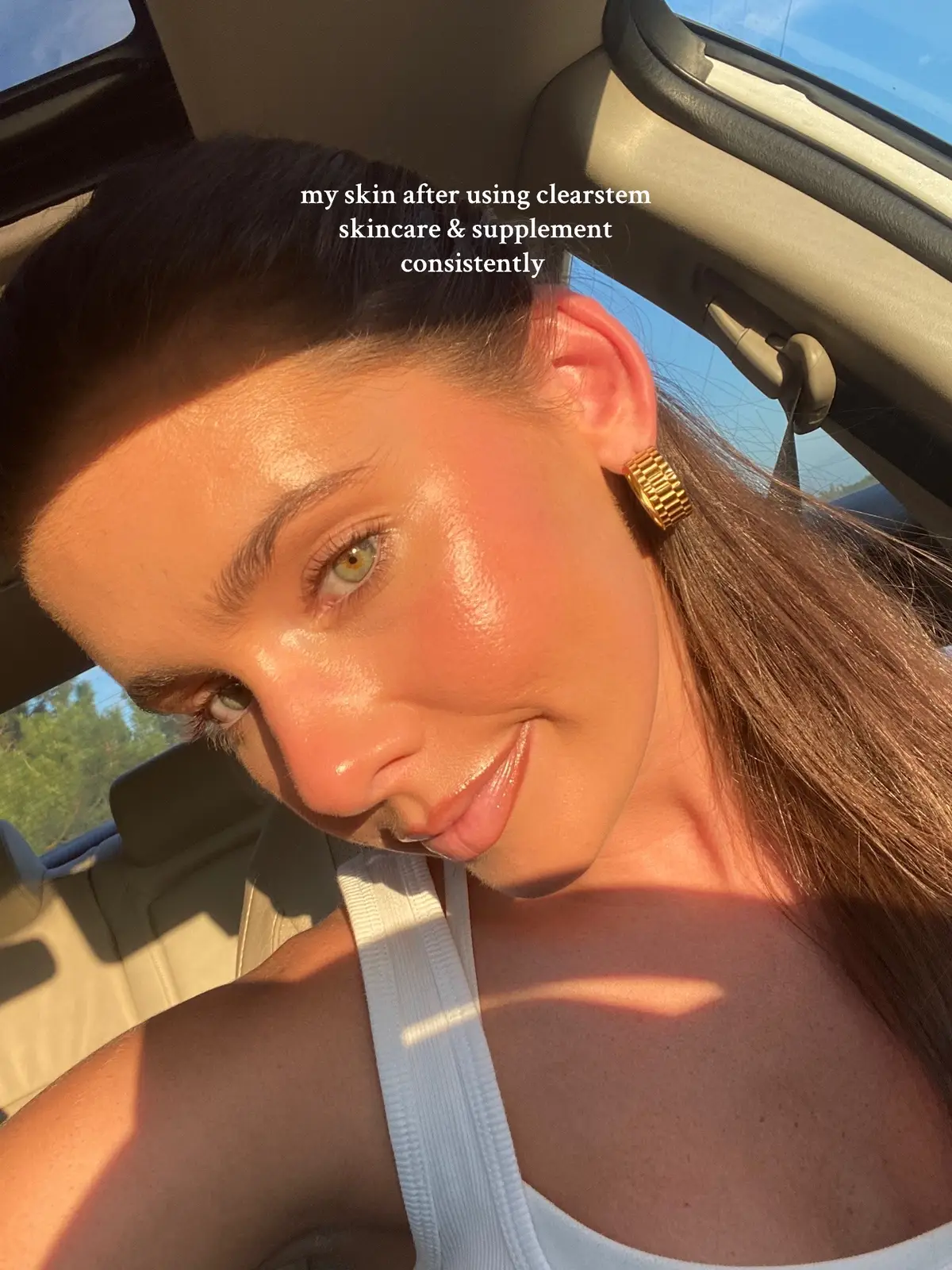 products that work >>>  my exact skincare routine is 🔗 in my bio! #skintiktok #healthyskin #skintiktok #clearskin #acneproneskin