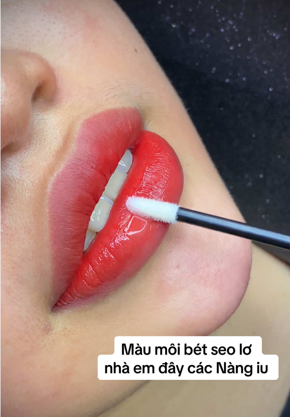 Màu môi bét seo lơ nhà em Ngà nè các Nàng iu ơi,, đôi môi khử thâm vừa dứt kim cho em SV năm 3 ĐH Nha Trang ạ #lamdep #xuhuong #khuthammoinhatrang #phunmoinhatrang #LearnOnTikTok 