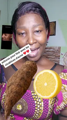 astuces contre les cicatrices d'acné #astucebeauté #cicatricesacne #skincare #beauté #tiktokcotedivoire🇨🇮 