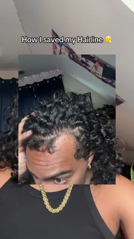 #hair #recedinghairline #hairoil #fyp #xyzbca 