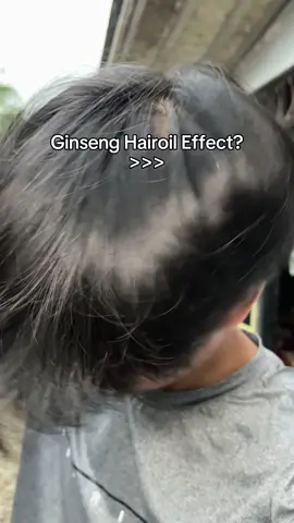 udh sepanjang ini aja rambut gw bjir la🥵 #rekomendasi #hairtonic #ginseng #hairstory #haircare 
