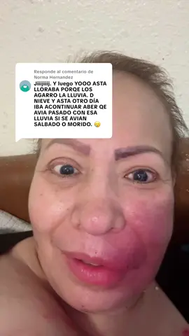 Respuesta a @Norma Hernandez 