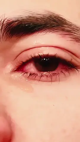 🥺💔#plzviral🥺🥺🙏🙏foryoupage #plzviral🥺🥺🙏🙏foryoupage #plzviral🥺🥺🙏🙏foryoupage #plzviral🥺🥺🙏🙏foryoupage #plzviral🥺🥺🙏🙏foryoupage 