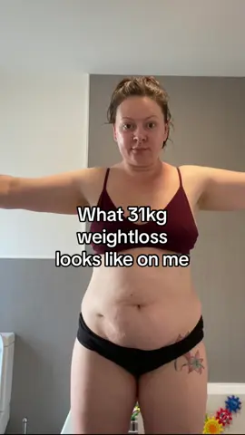 ✨ What a 31kg (69lbs) weight loss looks like on me at 5’9 ✨ From 16st 4 → 11st 4 in just 6 months 💪 How? ✅ Calorie deficit (not starvation!) ✅ Tracking & being honest with myself ✅ Moving my body more ✅ Prioritising protein ✅ Stopped comparing & focused on my journey Everyone’s path will look different – and that’s the beauty of it. 🌟 If you’re on your own journey: stay patient, stay consistent, and remember it’s YOU vs YOU ❤️ #weightlossjourney #caloriedeficit #fitnessjourney #beforeandafter #weightlosstransformation          