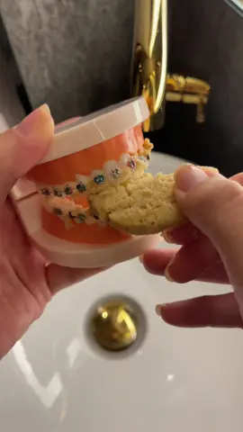 Brushing with braces SUCKS! But we made a solution 🤩 #braces #retainer #straightteeth 