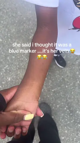 kids are funny #veins 