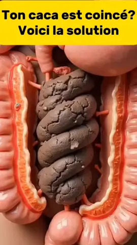 Ton caca est coincé?  Voici la solution  #constipation #caca #santepourtous #remedenaturel 