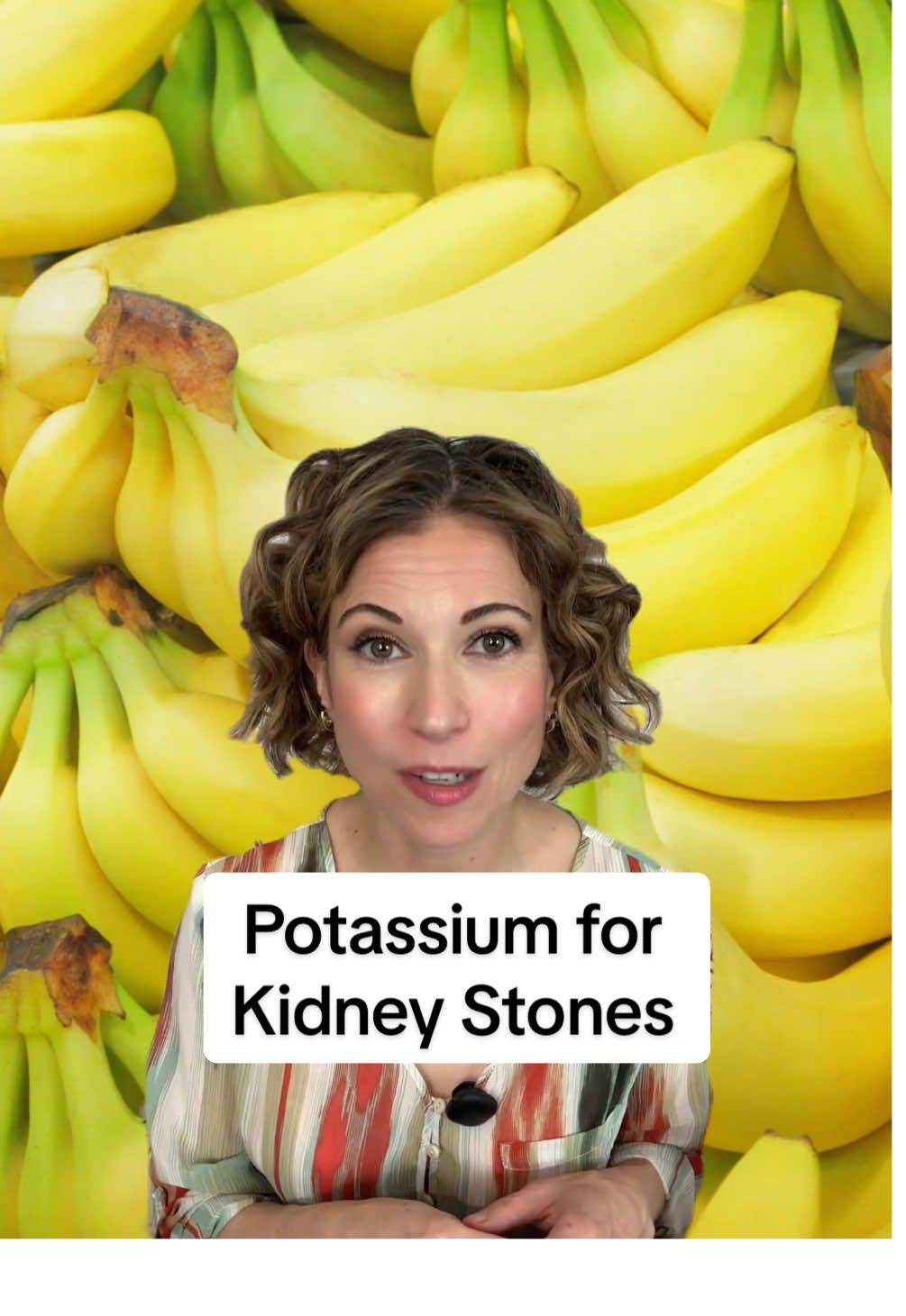 Potassium may help protect against kidney stones by decreasing urinary calcium excretion (a risk factor for kidney stone formation). Multiple large prospective cohort studies, like this one published in 2016, found that people in the highest quintile of potassium intake had up to a 56% lower risk of developing symptomatic kidney stones, compared to people in the lowest quintile of potassium intake. #nutrivore #nutrition #potassium #kidneystone #nutrients