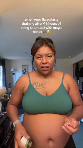 She does it again @MyMagicHealer 😭🙌🏾 #Hidradenitissuppurativa #hswarrior #hsawareness #hidradenitissuppurativawarrior #socialcydd 