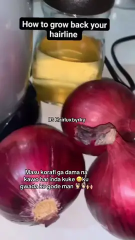 DIY onion oil for hairline 