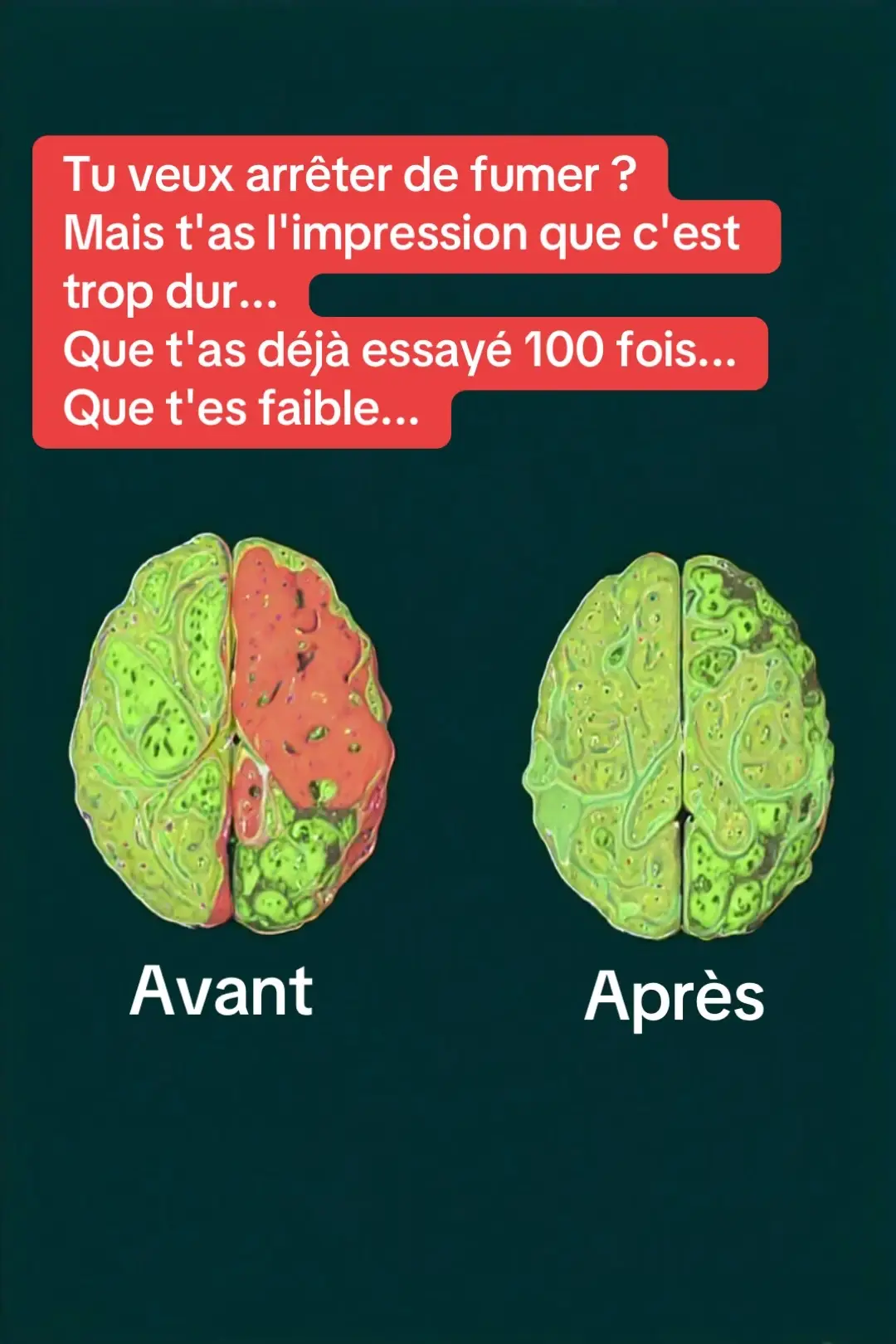 t'as l'impression que c'est trop dur... Que t'as déjà essayé 100 fois... Que t'es faible... Pourquoi ça marche : Ton cerveau a besoin de temps pour désapprendre la dépendance. Chaque envie ne dure que 3 minutes - si tu tiens 10 minutes, tu  tu réussiras à arrêter de fumer  arrête de t’avoir en écoutant cette fréquence pendant une minute par jour @hypnomedita  #s#stoptabacr#relaxationMéditation  #Fr#FréquencesDeGuerisond#addiction