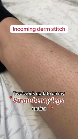 I suffer from KP too and this is exactly what helped my skin! Stitch with @Jolie #dermguru #kp #keratosispilaris #chickenskin #greenscreen 