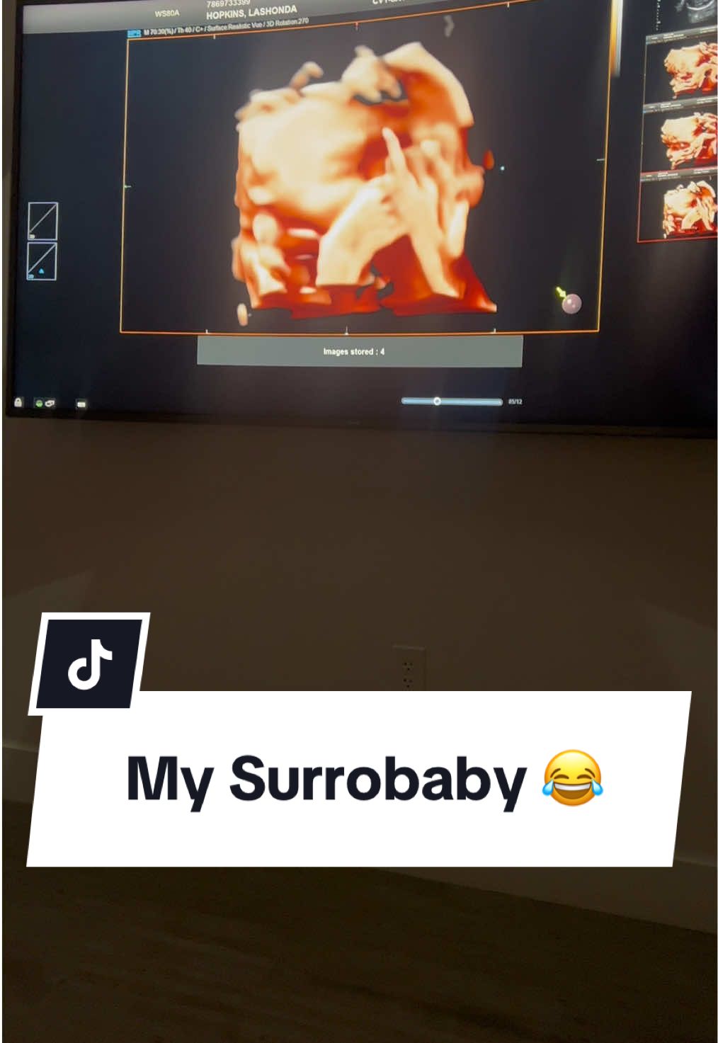 My surrobaby is already about that life! 😂 #surrobaby #surrogate #blacksurrogate 