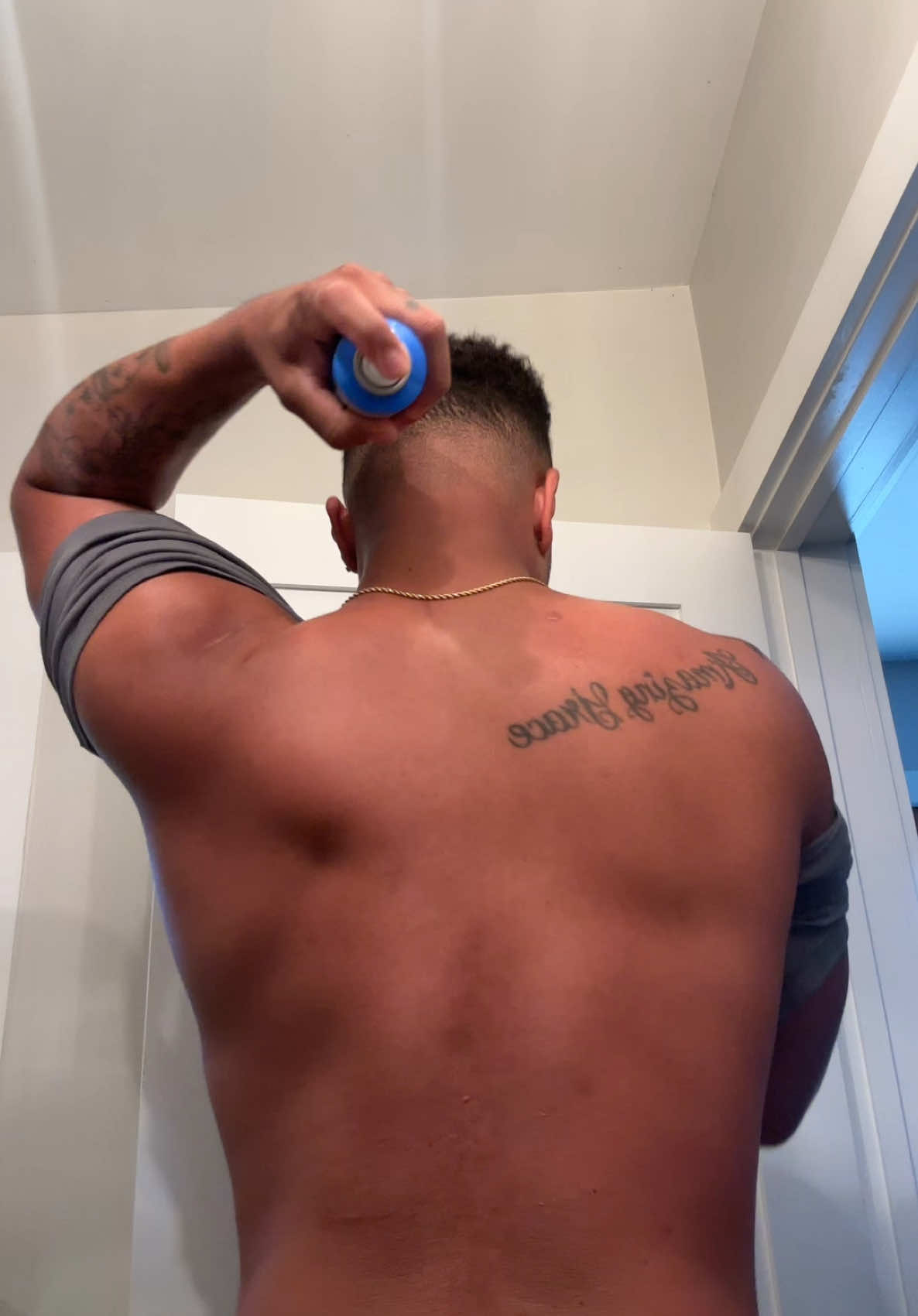 Day 2 sunburn update #fyp #help #foryoupage #sunburn 