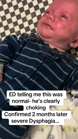 Beyond pissed at the NICU for NOT doing a swallow study when I requested it because of feeding issues then.. 2 months later and multiple ED trips- has a swallow study and he has to go back to tube feeding because he’s aspirating with his bottles. #advocate #advocateforyourchild #nicubaby #preemie #feedingtubeawareness 