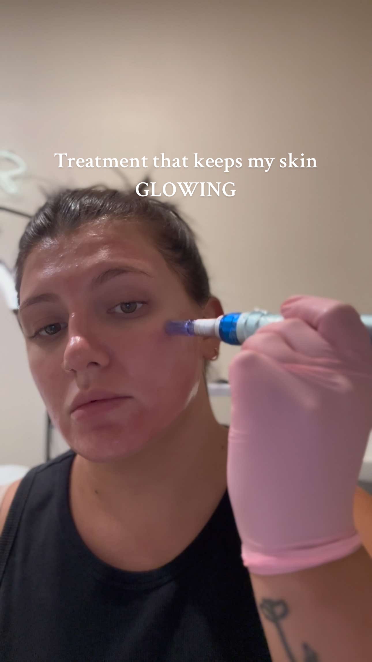 *this is an old draft* 😂  Don’t sleep on microneedling 😍 Microneedling creates micro wounds in this skin to promote healing, induces collagen, tightens, helps with scarring and big pores! My favorite treatment  #skincare #skintreatment #skin #skintok #skintips #creatorsearchinsights #asmr #clearskin #acnejourney #fyp #foryoupage 