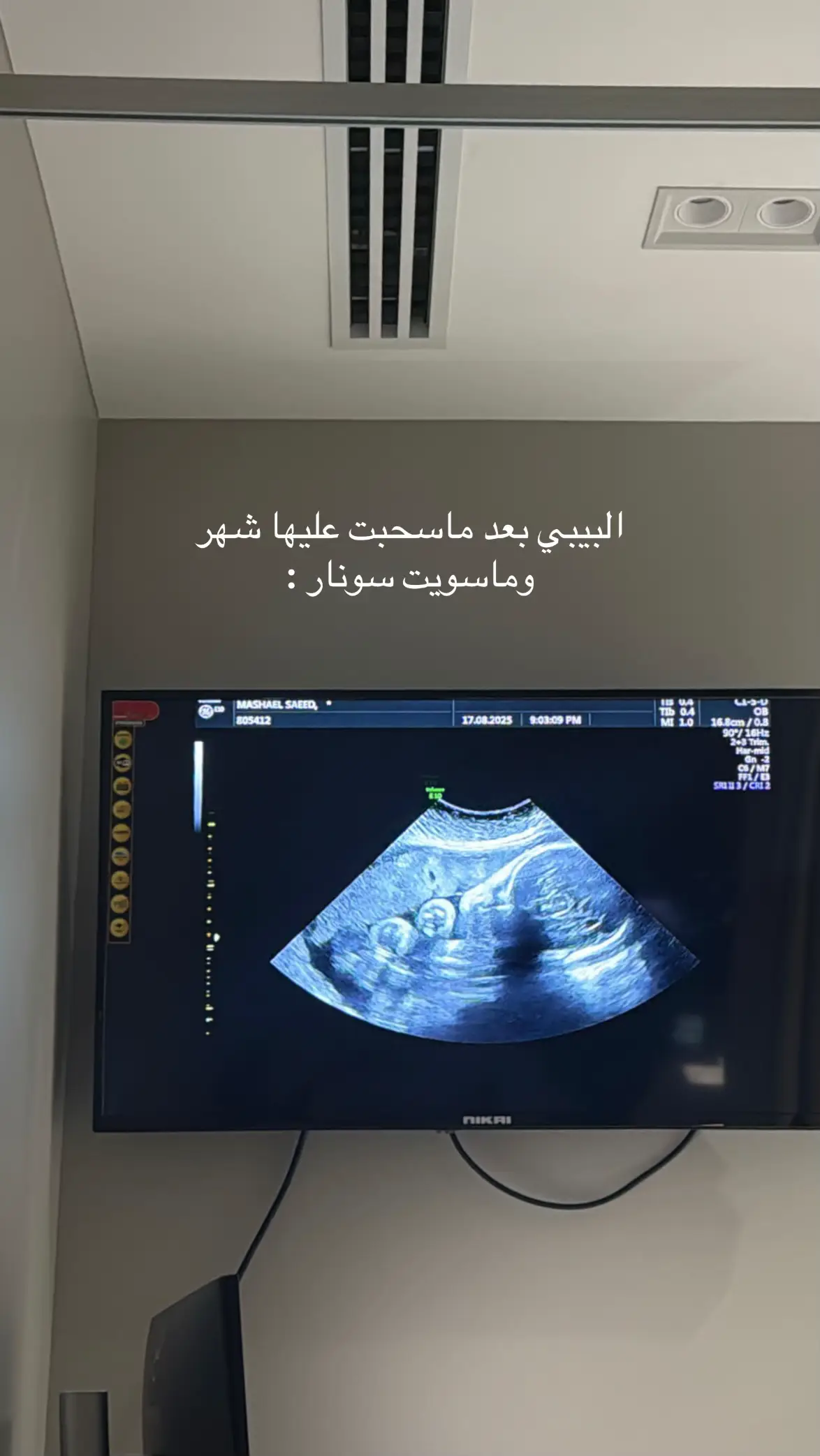 #اكسبلور #ترندات_تيك_توك #foryou 