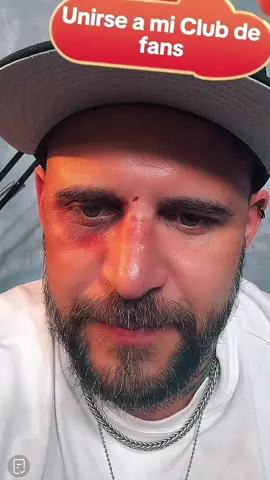 Que le pasó @El Temach en el ojo contexto un juego de futbol terminó en callejero #temach #temachmotivacion #eltemachayuda 