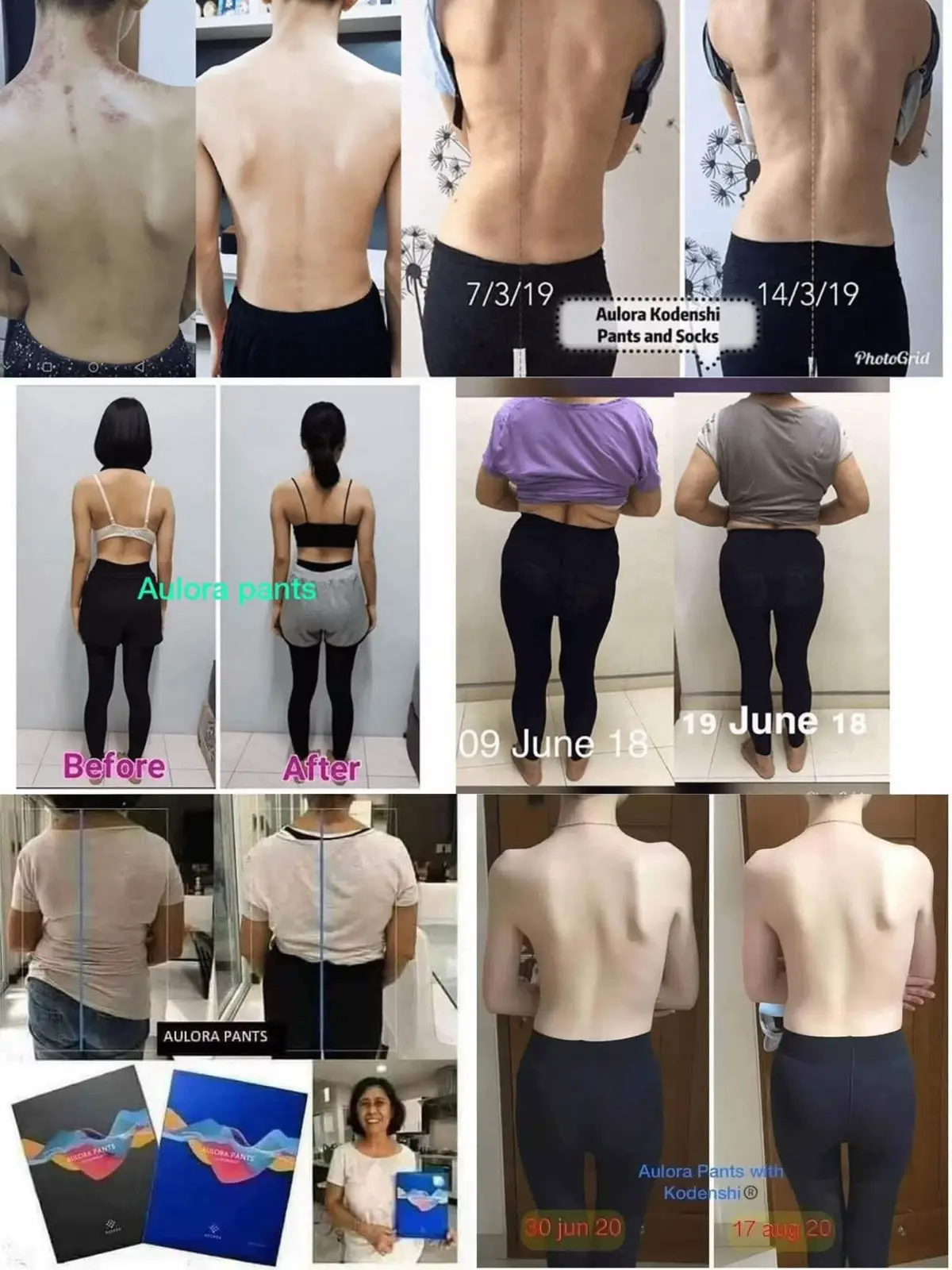 #scoliosis #aulorapantswithkodenshi #aulorapants 
