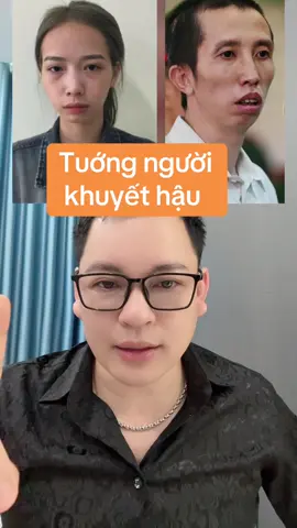 Tướng người khuyết hậu #suhuongtiktok #nhantuonghoc 