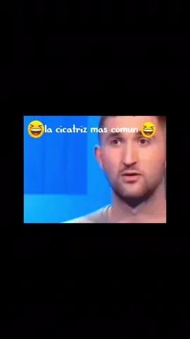 la cicatriz mas comun😂 #videosdivertidos #funnyvideos #videosderisa #videosdehumor #risastiktok 
