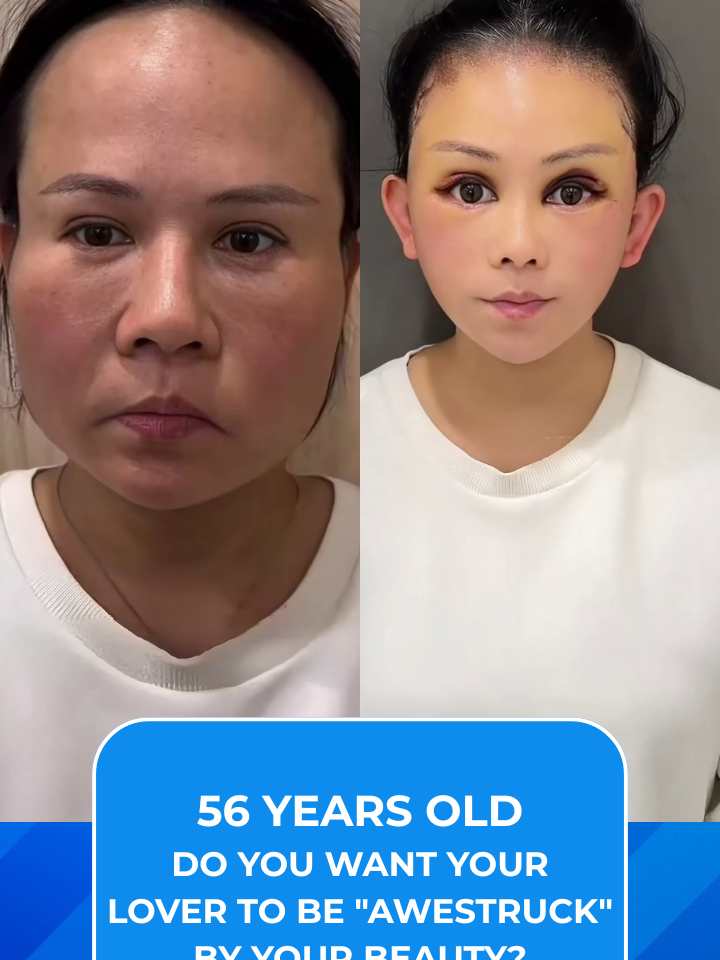 #necklift #chin #lips #rhinoplasty #eyelid #eyebrow #liposuction #abdominalliposuction #facelift #fullbodyliposuction #fatgrafting #surgery #Facelift #fullface #neckliftb #indonesia #sedotlemak #Sedotlemakperut