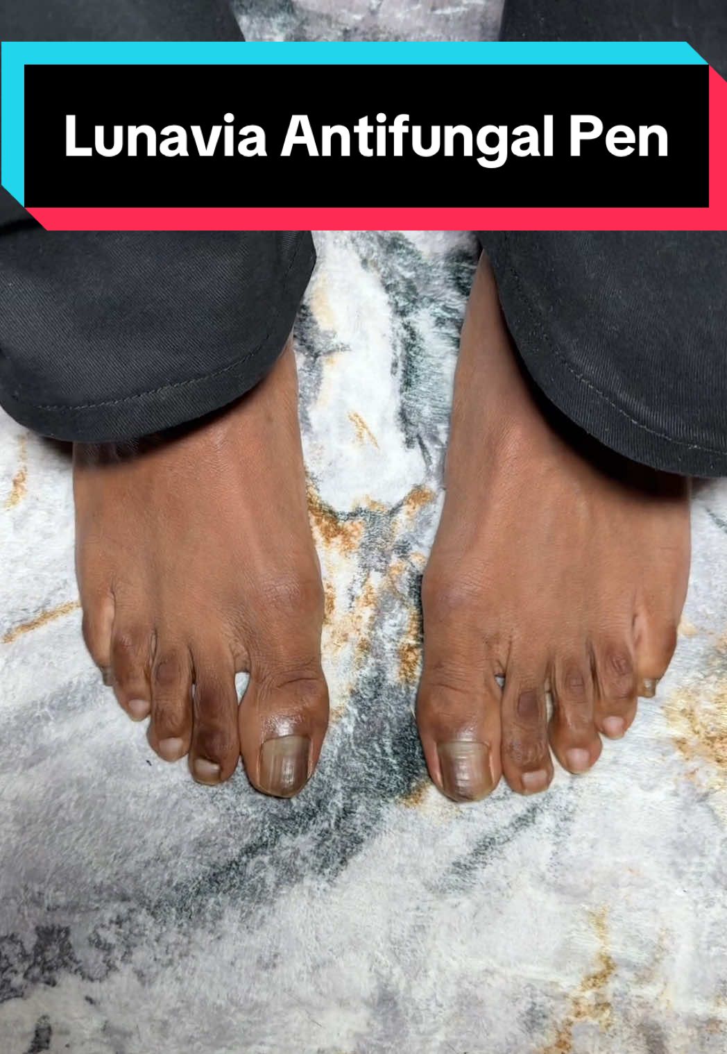 Replying to @lena Day 9 of my feet journey...@mylunavia #TikTokShopCreatorPicks #toefungus #HealthMustHaves #Pedicure #tiktokmademebuyit