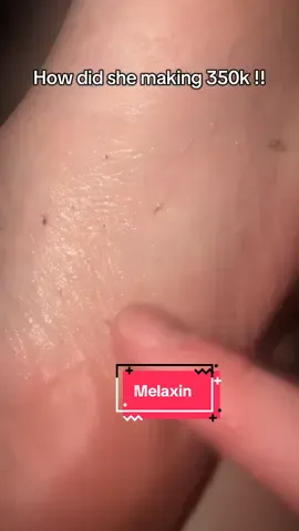 #drmelaxin #peelshot #skincaretok #kbeauty #skincareroutine          
