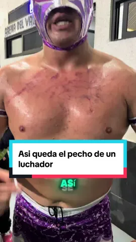 Los quiero @☀️HELIOS ☀️  y #reiyel luchadores de a#arenadelvalle #luchlibre #pierrotaso #medicinadeldeporte 
