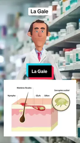 La Gale 