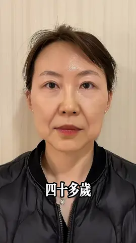 #台灣 #台北 #台中 #高雄 #面部抗衰 #面部年輕化 #逆齡變美逆襲 #逆齡 #筋膜提升