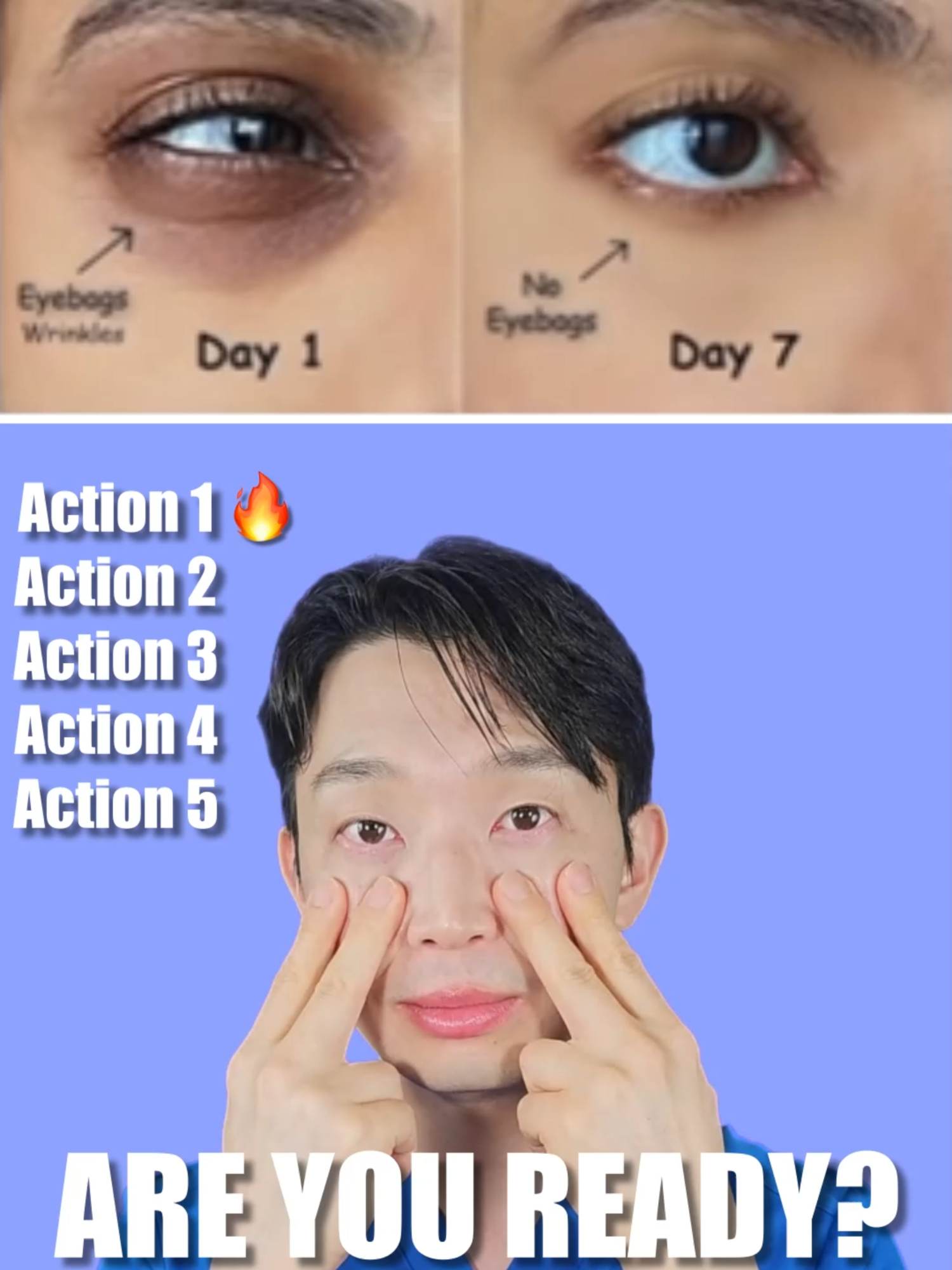 이거 하면 10살 어려져 보입니다 Look 10 Years Younger With This Move #FaceYoga #UnderEyeCare #GlowUp #Shorts #SelfCare