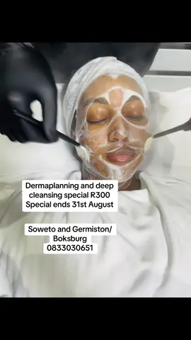 #shobeauty #dermaplaning #facialtreatment #skincare #hyperpigmentation 