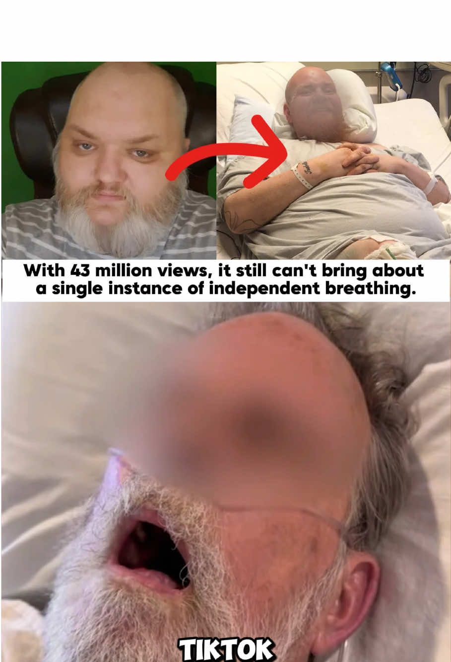 With 43 million views, it still can't bring about a single instance of independent breathing.#usa_tiktok #news #usa #johncrawley #kingbeard 