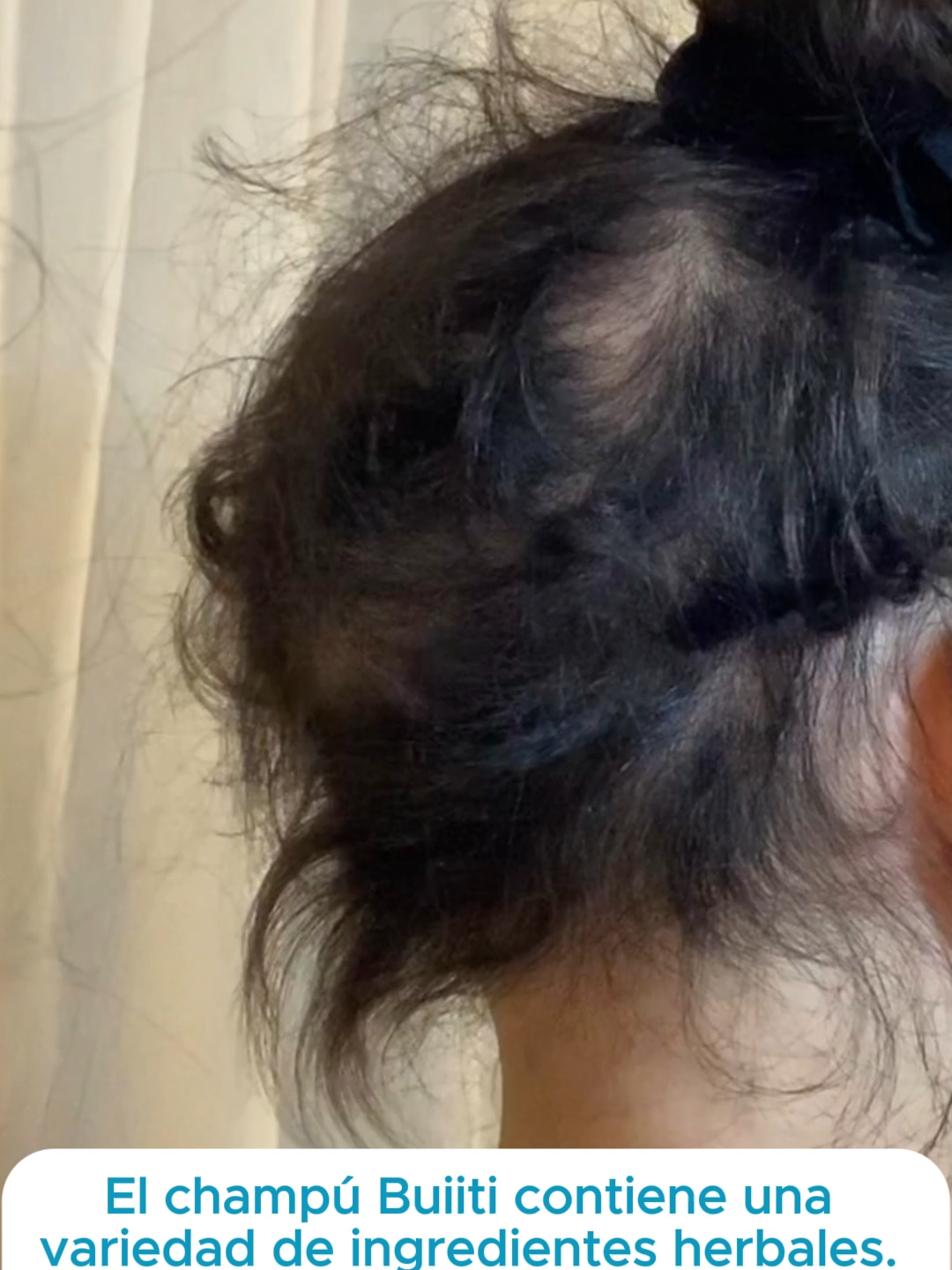 Mi amiga me lo recomendó y ¡es genial! Si tienes problemas de caída del cabello, ¡pruébalo!#HairGrowth #StopHairLoss #HairGrowthTips #ScalpCare #healthyhair #reducehairloss #tiktokshop #tiktokmademebuyit #naturalhaircarecommunity #flashsalec #dealsforyoudays #hairgrowth #thickerhair #rosemaryshampoo #fyp #newyork #fup #losangeles #Buiiti #batanarosemaryonionshampoo