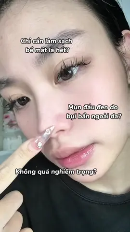 Mụn đầu đen tái đi tái lại? Tôi đã tìm ra bí quyết cho da đẹp rùi🤩 Phần 274: Combo Gel rửa mặt & Kem dưỡng mụn La Roche-Posay🫧🫧 #effaclar #larocheposaypartner #TikTokFinds #depdachieu #giammun 