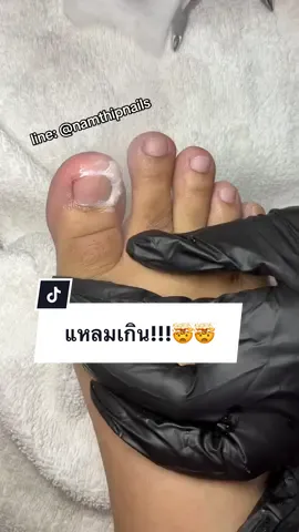 💓 #namthipnails #ตัดเล็บขบ #ตัดหนัง #ทำเล็บ #ร้านตัดเล็บขบ      Fb : namthipnails  Line : @namthipnails  นัมเบอร์วัน8 ตลาดม.ราม2  กทม  Map: namthipnails  https://goo.gl/maps/JmwpCKLfKwmhKGK96  ร้านเปิดทุกวัน เวลา12.00น-22.00น.