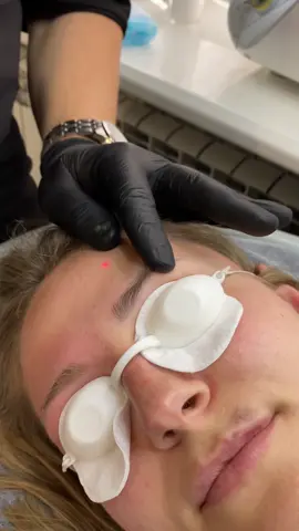 #видаленняперманенту #permanentmakeup #permanenteyebrows #татуажбрів #permanentmakeupremoval 