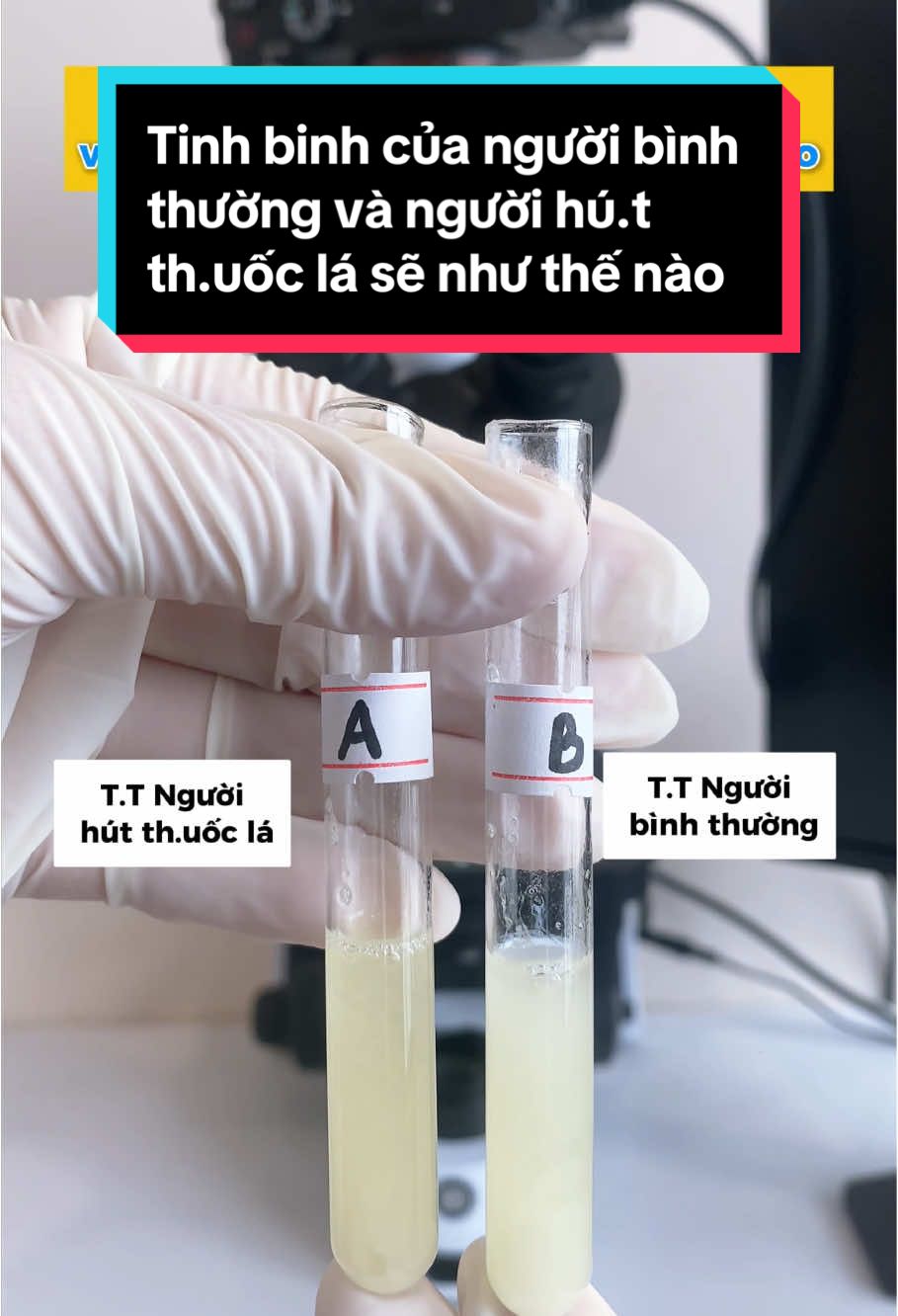 Tinh binh của người bình thường và người h.út th.uốc l.á sẽ  như thế nào ?? #tinhbinh #kinhhienvi  #xuhuongtiktok  #education  #LearnOnTikTok  #suckhoe 
