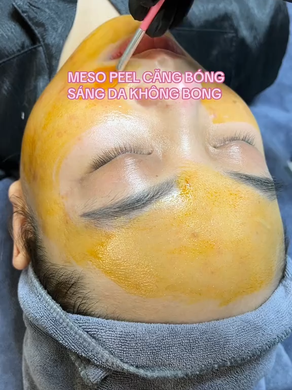 Bạn có biết? 🌸 Không cần phải ra spa tốn kém hay mất thời gian, giờ đây bạn vẫn có thể sở hữu làn da trắng sáng, mịn màng ngay tại nhà với Mesopeel – Peel không bong của Mesoestetic. 💎 Sản phẩm giúp cải thiện thâm sạm, làm đều màu da, se khít lỗ chân lông và mang lại vẻ rạng rỡ tự nhiên chỉ sau liệu trình ngắn. Đặc biệt, đây là dòng peel không bong tróc, không đau rát, không nghỉ dưỡng, cực kỳ phù hợp cho những ai bận rộn nhưng vẫn muốn chăm sóc da chuyên sâu. 📦 1 chai dùng được 30–40 lần, giá chỉ 3xxx, tiết kiệm hơn rất nhiều so với đi spa mà hiệu quả vẫn được đảm bảo. Shop còn cung cấp quy trình làm tại nhà đầy đủ để bạn yên tâm tự thực hiện. 📍 Shop Hà Nội 📞 0396772354 #TimesCity #RoyalCity #Landmark81 #VinhomesGoldenRiver #VinhomesCentralPark